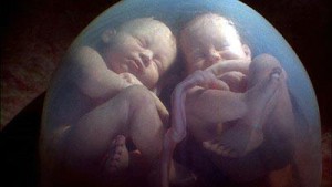 twins-womb